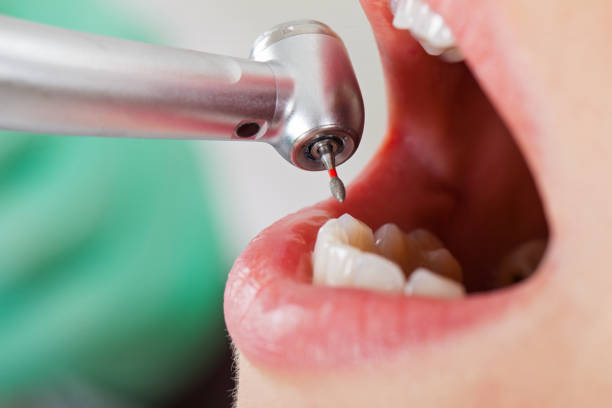 Best Emergency Root Canal Therapy in Mount Pulaski, IL